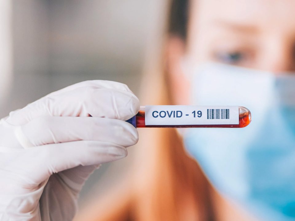 covid 19 ab areias